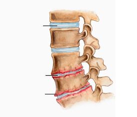 Osteochonds