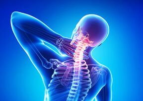 Unzeeche vun der Gebärmutteral Osteochendrosis
