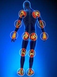 Lokaliséierung vu Gelenker betraff vun Arthrosis