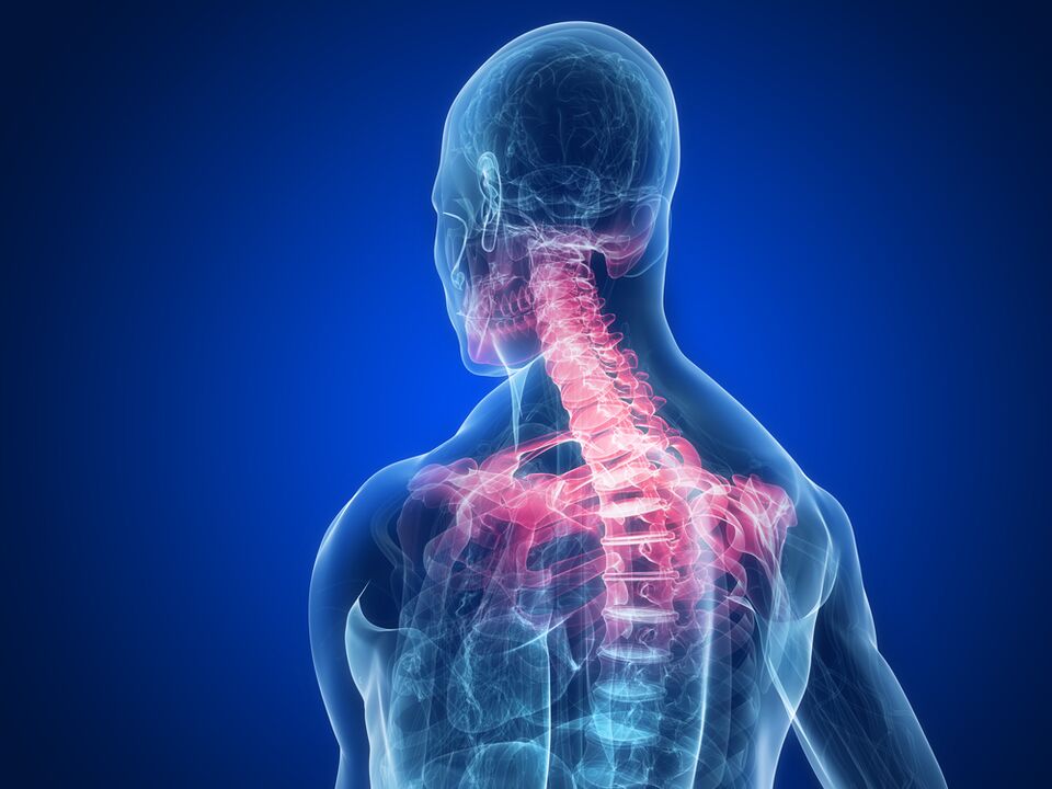 Spondyloarthrose als Ursaach vu Schmerz tëscht de Schëllerblades