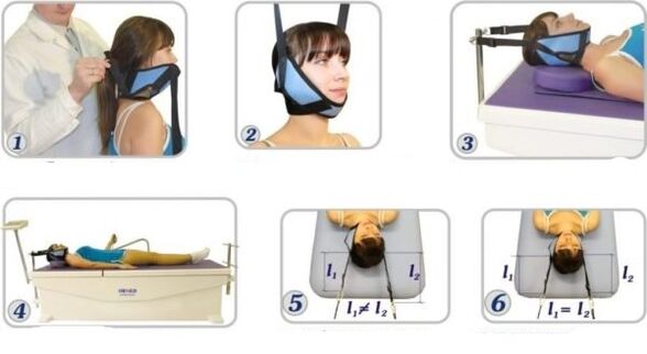 Behandlung vun cervical osteochondrosis mat Traktioun