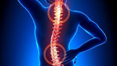 Mechanismus vun der Entwécklung vun Osteochondrose