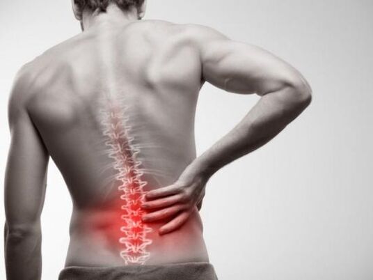 Rückenschmerzen an der Lendenbereich